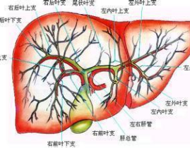 肝胆管结石症状,症状解析与防治要点
